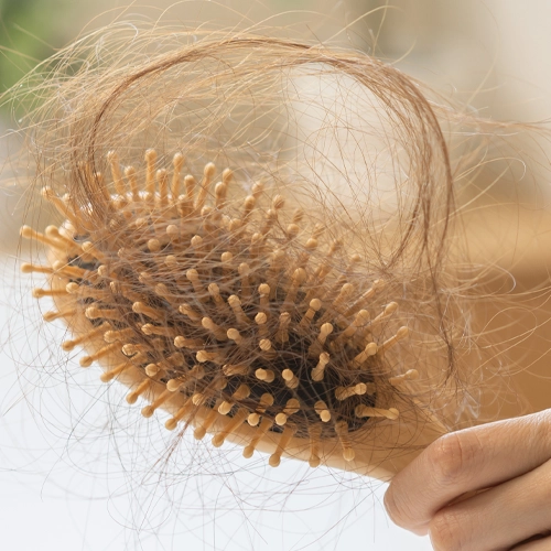Jak zabránit nadměrnému vypadávání vlasů? – nejlepší přípravky