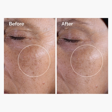 The Ordinary - Glycolic Acid 7% Exfoliating Toner - Exfoliační tonikum se 7% kyselinou glykolovou - 100 ml