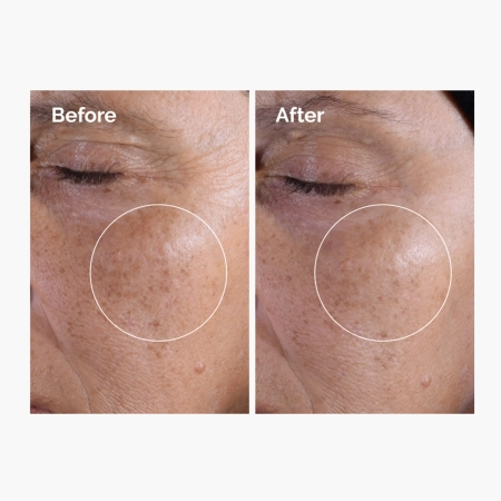 The Ordinary - Glycolic Acid 7% Exfoliating Toner - Exfoliační tonikum se 7% kyselinou glykolovou - 240 ml