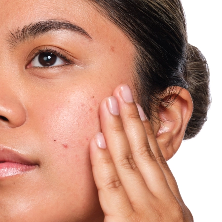 The Ordinary - Salicylic Acid 2% Solution - Sérum s kyselinou salicylovou - 30 ml