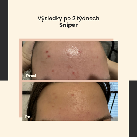 SkinTra - Sniper - Krém na nedokonalosti - 20 ml 