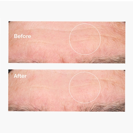 The Ordinary - Hyaluronic Acid 2% + B5 - Hydratační sérum s kyselinou hyaluronovou 2 % a vitamínem B5 - 60 ml