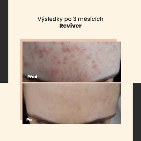 SkinTra - Reviver - Revitalizační sérum - 30 ml