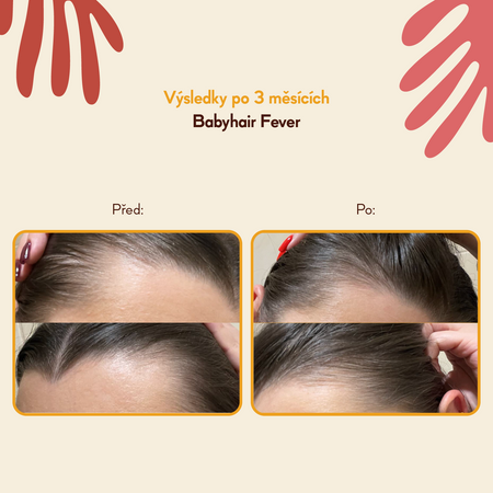 HairTry - Babyhair Fever - Rozehřívací tonikum pro růst vlasů - 100 ml