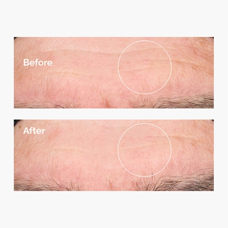 The Ordinary - Hyaluronic Acid 2% + B5 - Hydratační sérum s kyselinou hyaluronovou 2 % a vitamínem B5 - 30 ml