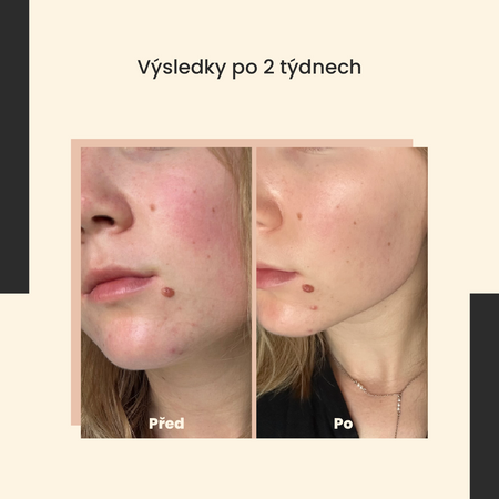 SkinTra - Ceramide Cuddles - Regenerační sérum - 30 ml 