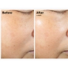 The Ordinary - Rice Lipids + Ectoin Microemulsion - Mikroemulze s rýžovými lipidy a ektoinem - 120 ml