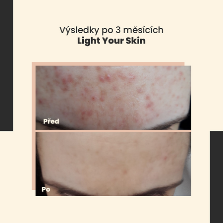 SkinTra - Light Your Skin - Sérum s vitaminem C 20% a kyselinou ferulovou - 30 ml