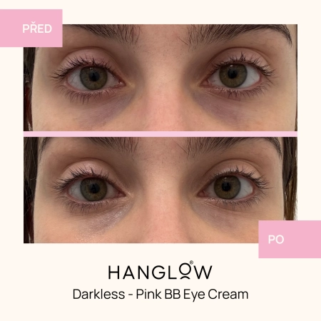 HanGlow - Darkless - Pink BB Eye Cream - Krém-Korektor pod oči - 15 ml