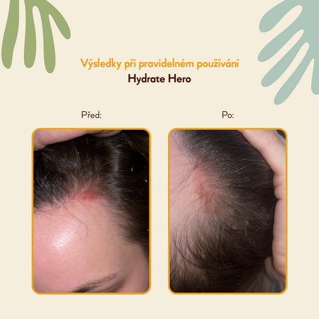 HairTry - Hydrate Hero - Hydratační a zklidňující tonikum pro pokožku hlavy s NMF komplexem a Ektoinem - 100 ml